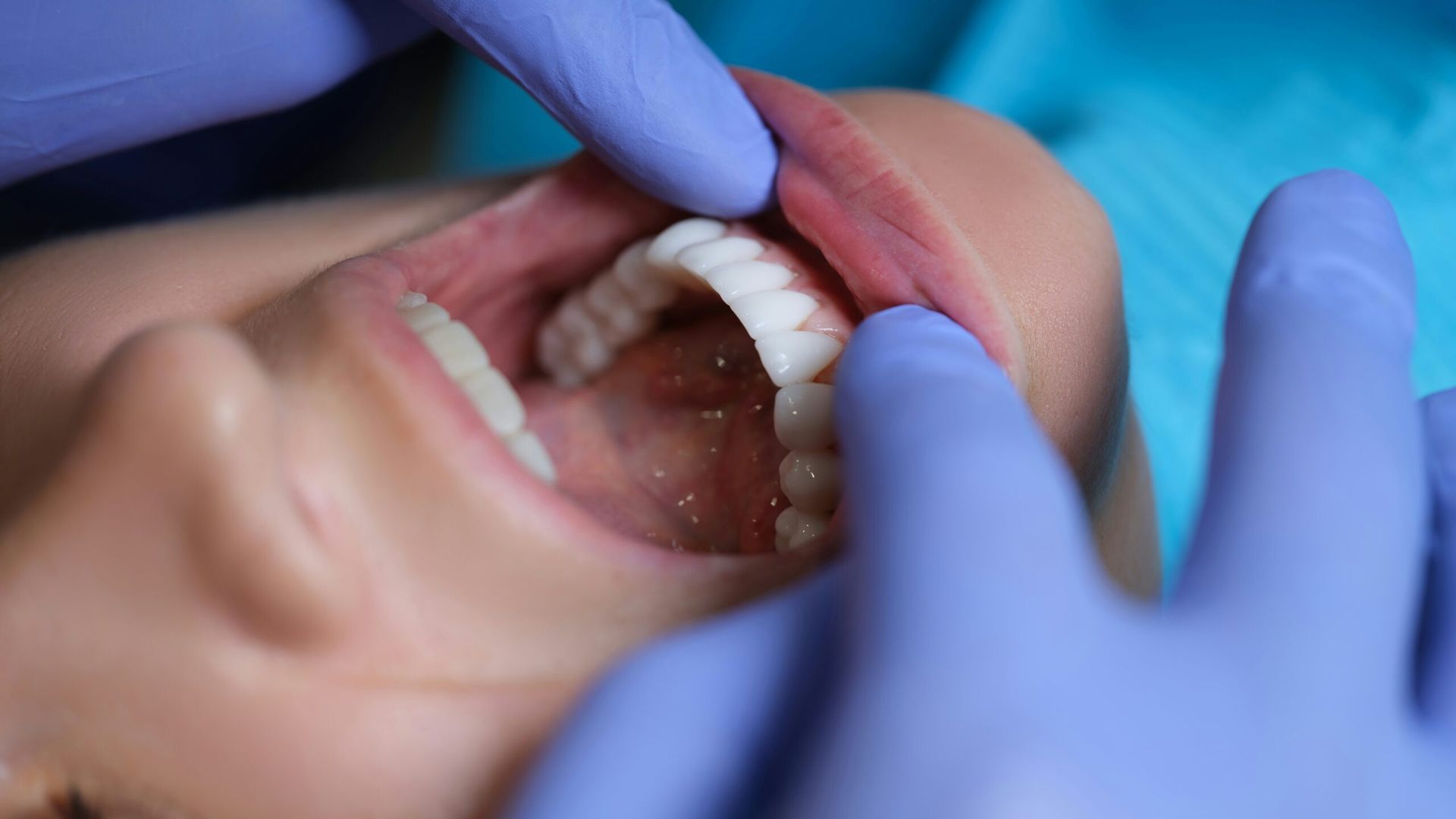 GD Dentistry Teeth In A Day Advances Dental Technology With Same-Day Full Arch Implants